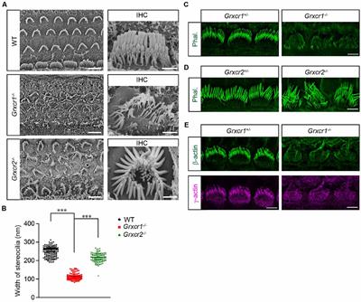 Murine GRXCR1 Has a Different Function Than GRXCR2 in the Morphogenesis of Stereocilia